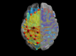 TMS to treat depression